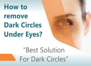 How to remove dark circles permanently